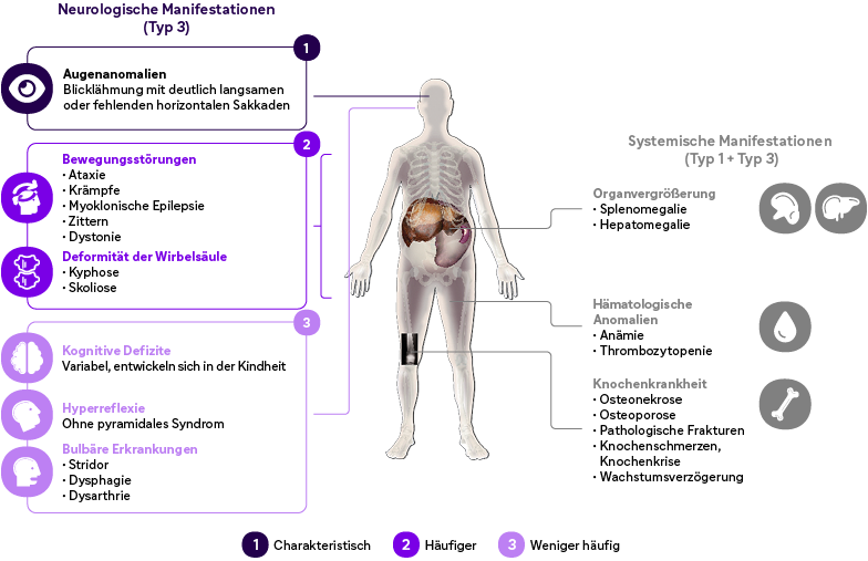 Grafik zeigt neurologische und systemische Manifestationen mit menschlicher Silhouette, farblich markierten Organen und Listen zu Symptomen wie Bewegungsstörungen, kognitiven Defiziten und Organvergrößerungen.