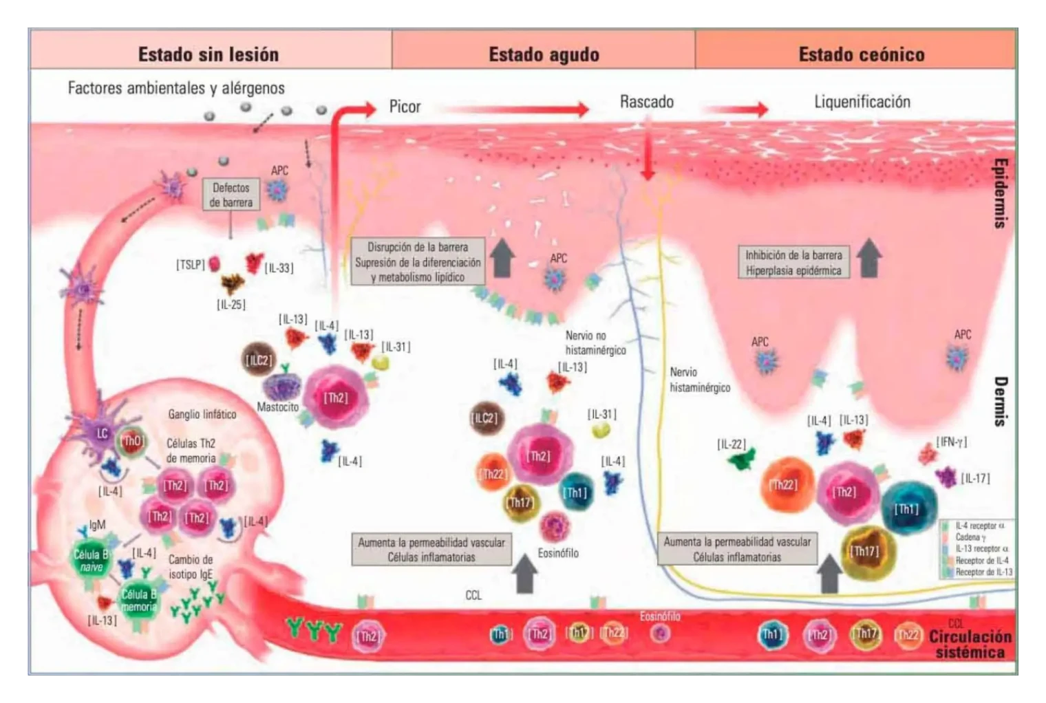 imagen patogenesis dermatitis atípica