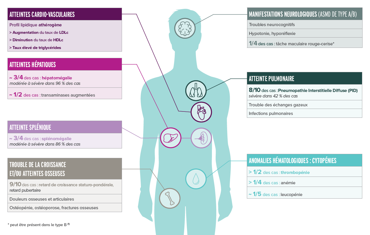 Manifestations neurologiques de l'ASMD