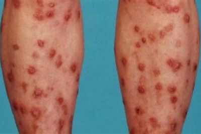 skin-symptoms