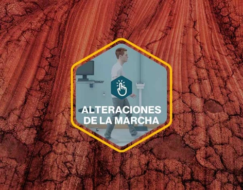 alteraciones-marcha-card