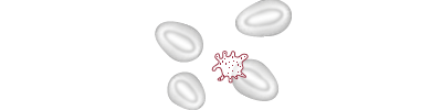 thrombocytopenia mobile figure