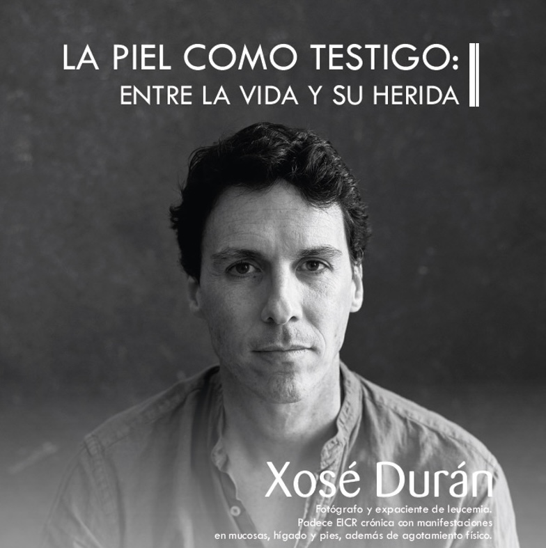 Xosé Durán